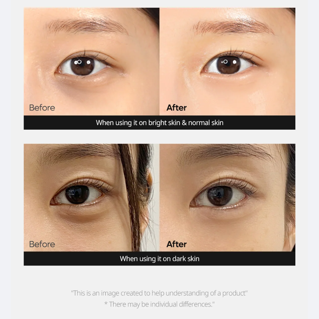 Cemenrete Calcium Dark Spot Cover Eye Cream
