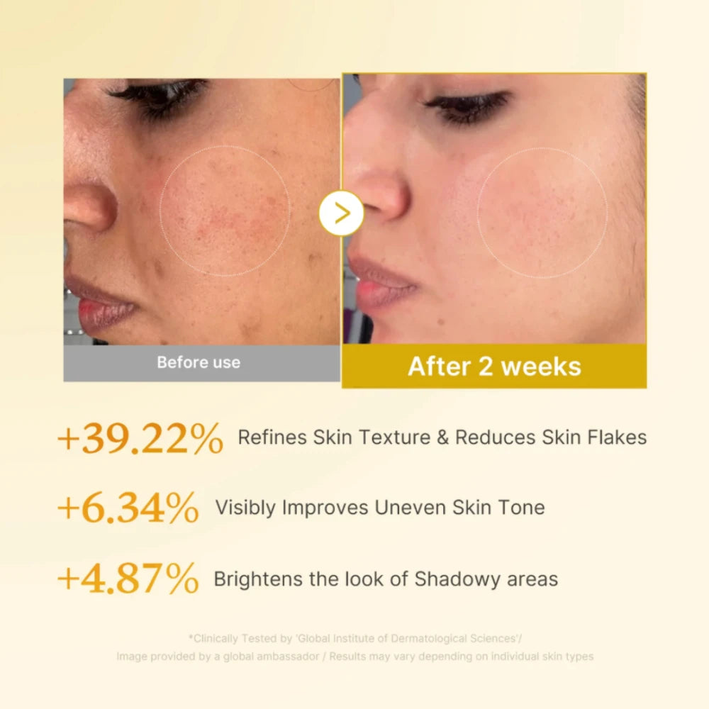 Kojic Acid Turmeric Resurfacing Toner