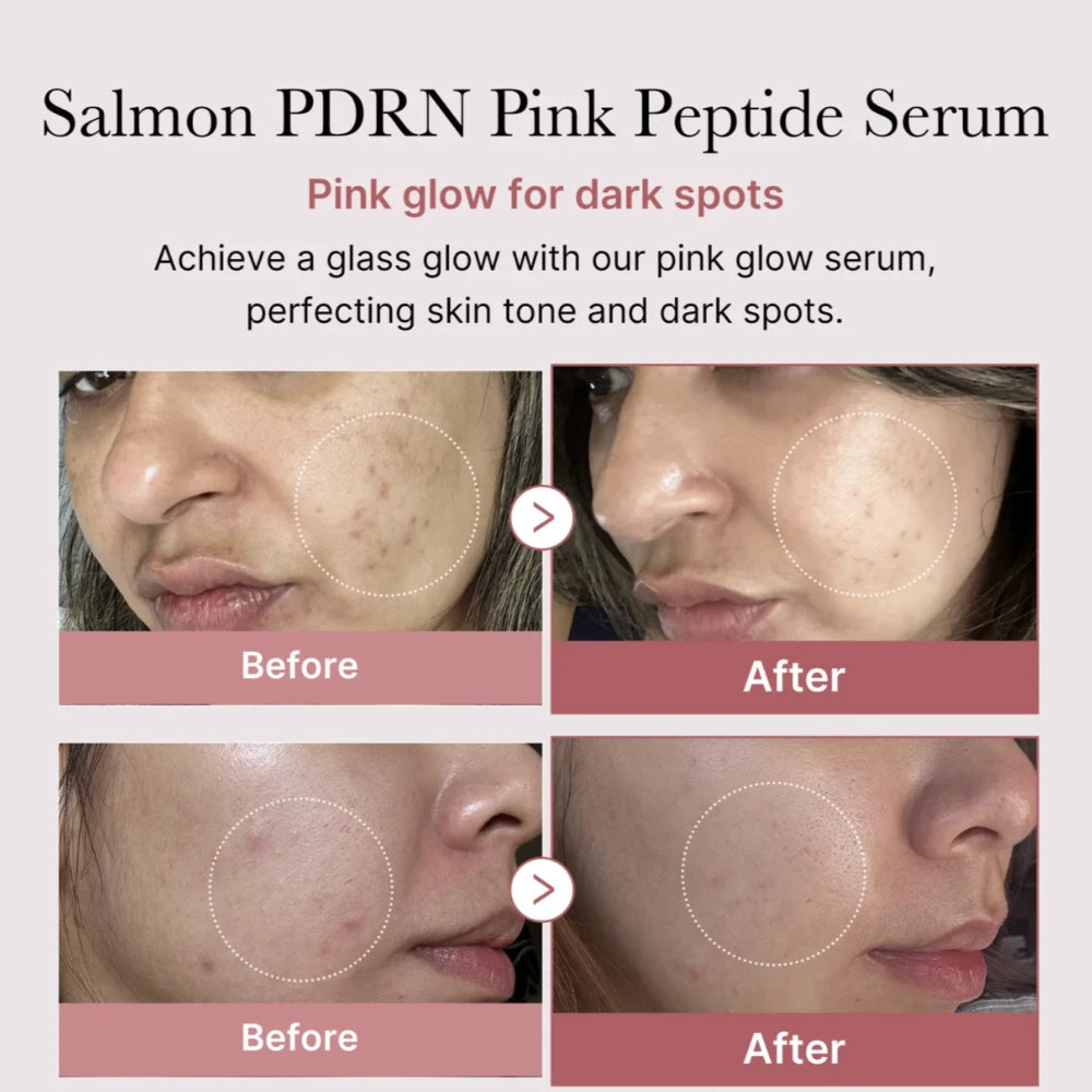 Collagen PDRN Pink Peptide Serum