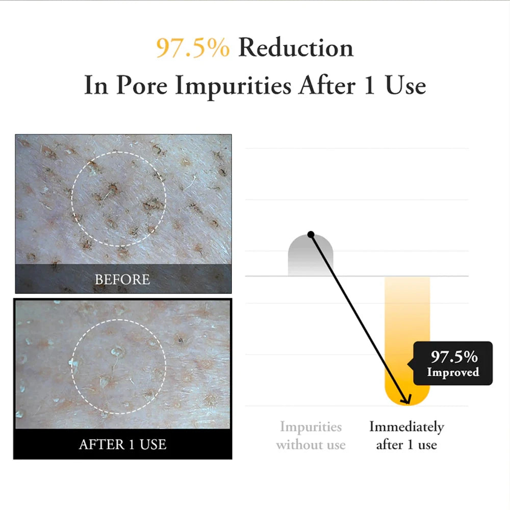 Real Calendula Peel Off Mask