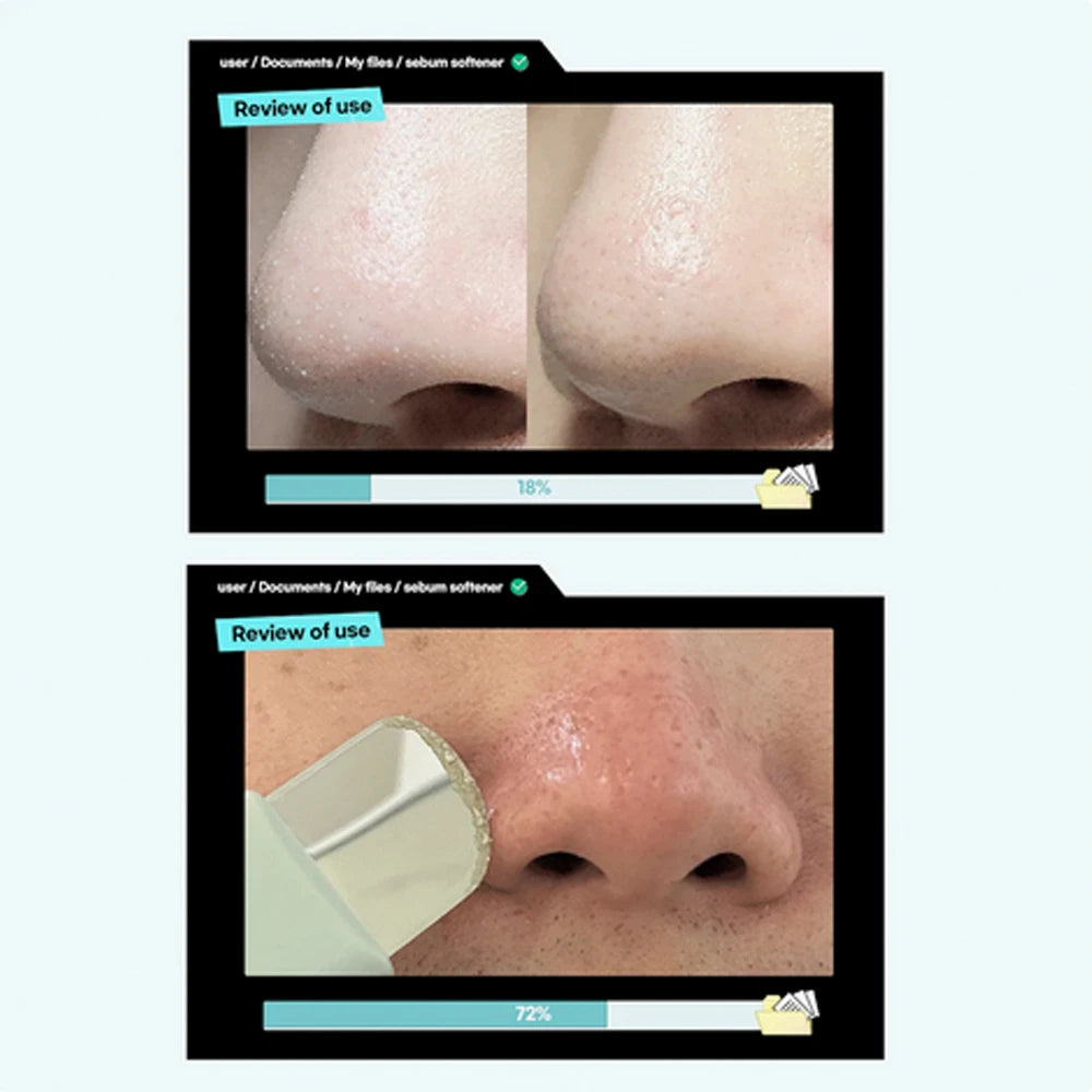 Super Melting Sebum Softener