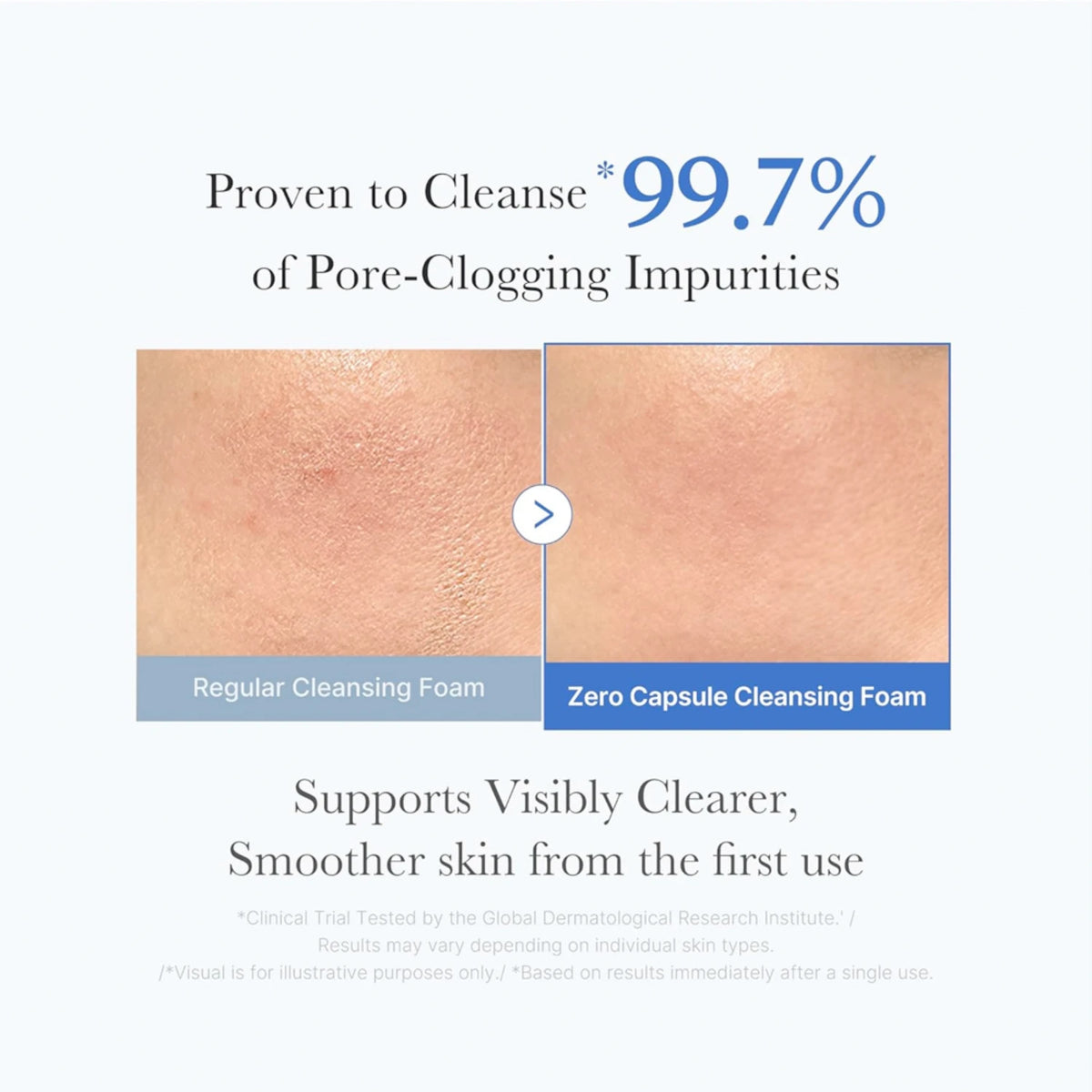 Zero Pore Clearing Capsule Cleansing Foam