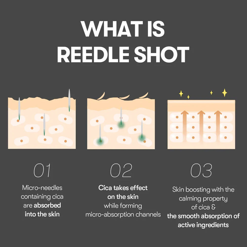 VT Reedle shot 100