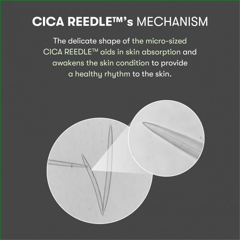 Mild VT Reedle shot 50
