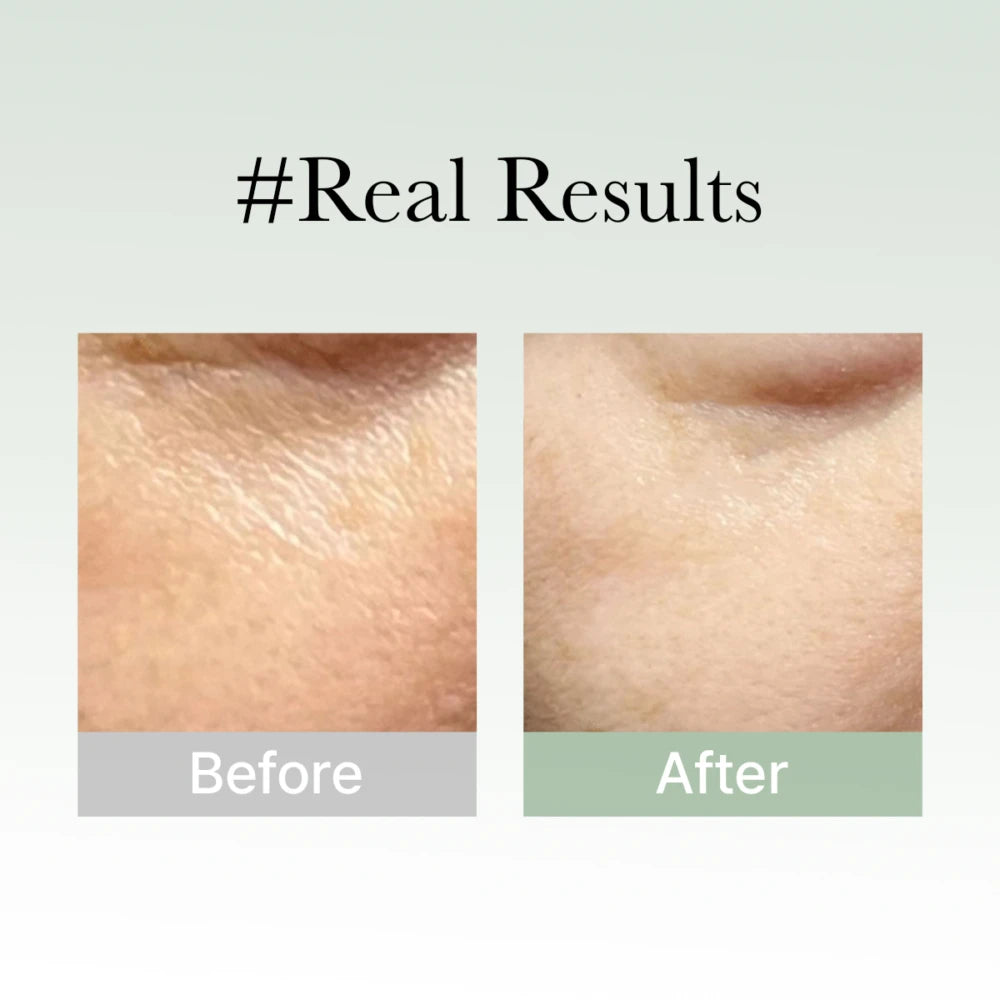 Holy Hyssop Serum 30