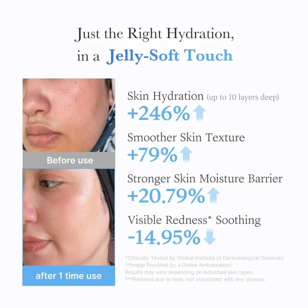 Hyaluronic Ceramide Jelly Cream