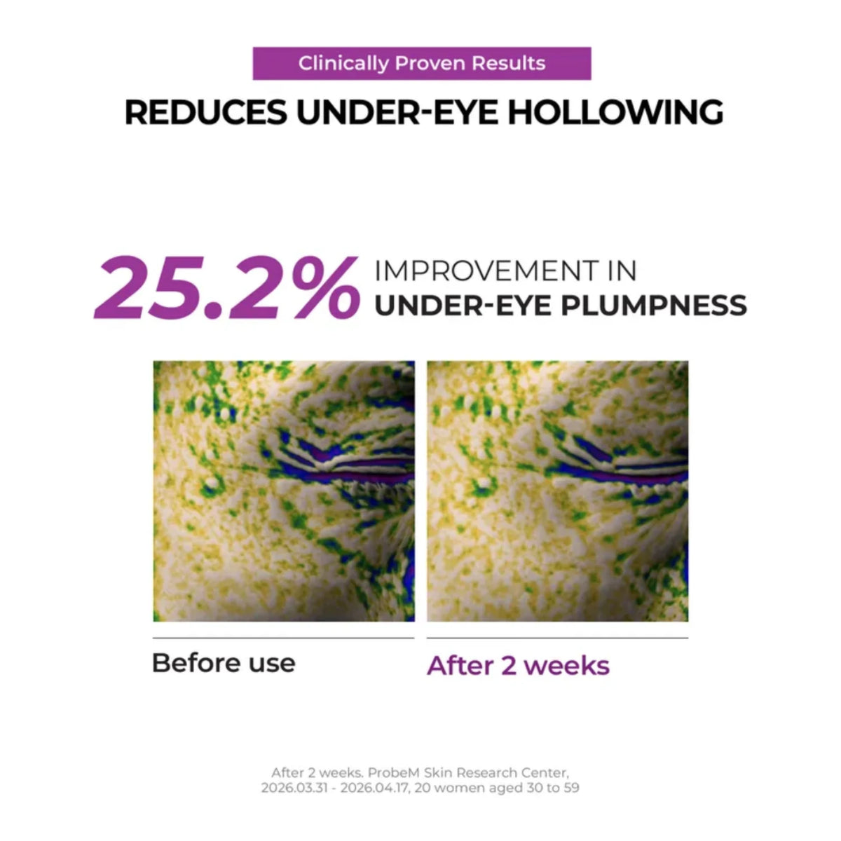 Niacinamide 5+ Dark Circle Correcting Eye Cream