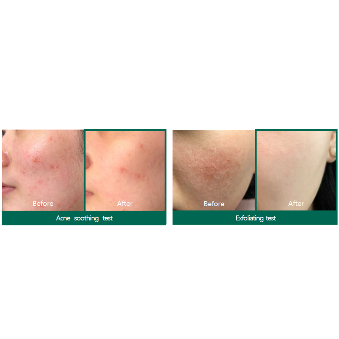 AHA BHA PHA 30 Days Miracle Foam