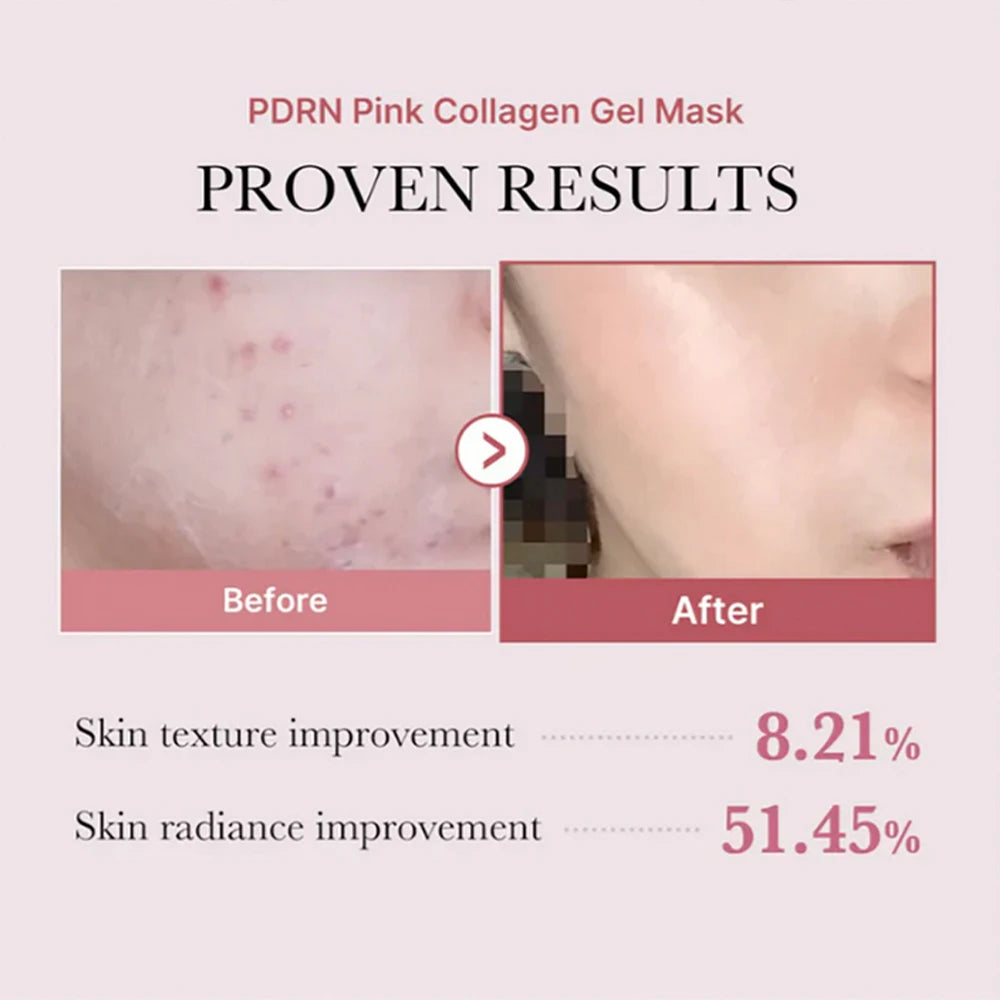 PDRN Pink Collagen Gel Mask