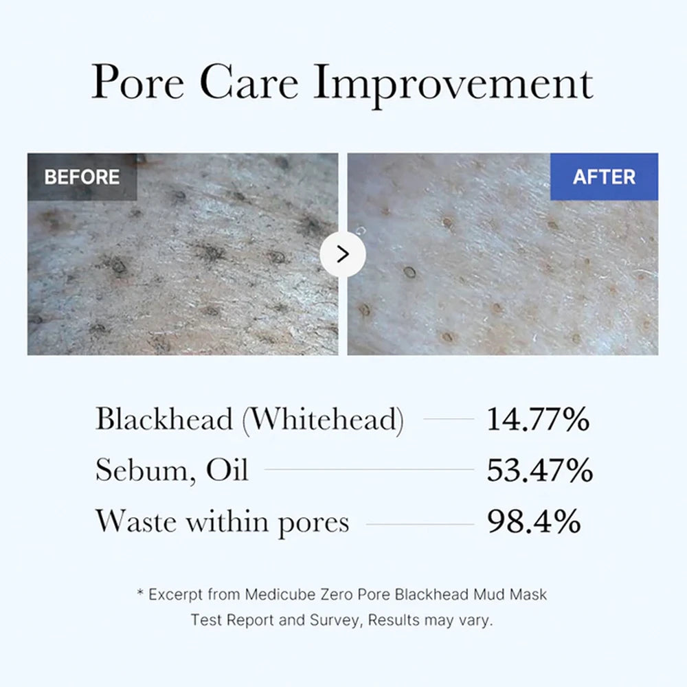 Zero Pore Blackhead Mud Mask