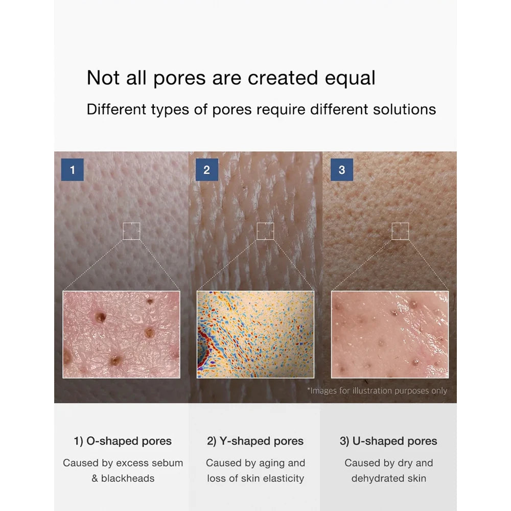 Zero Pore One Day Serum