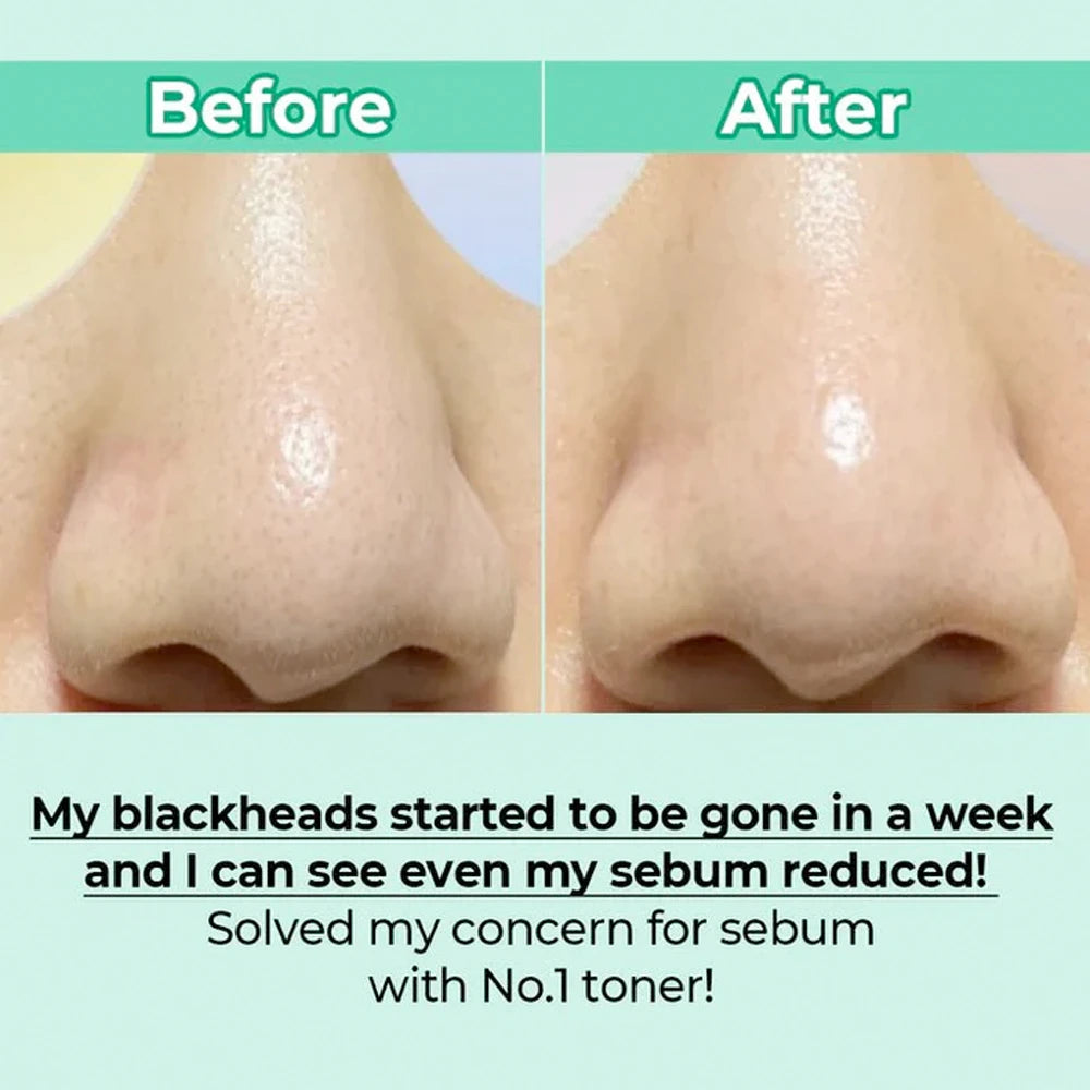 No.1 Pure-full Calming Herb Toner