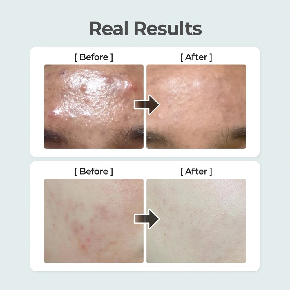 No.1 Pure-full Calming Herb Toner